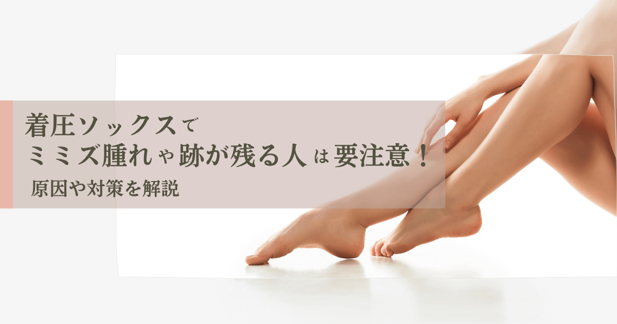 着圧ソックスでミミズ腫れが残る人